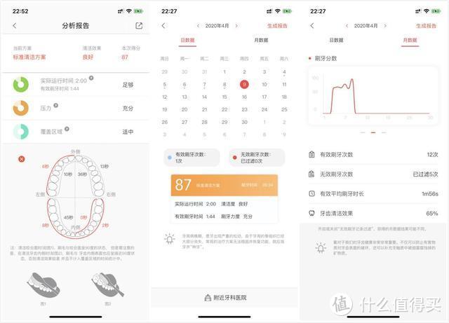 夏小辰玩机 篇六：Oclean X 智能触屏声波电动牙刷评测：你刷牙的方式真的对了吗？