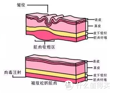 面部皱纹如何改善，看这里，别让岁月侵蚀了你的美！