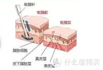 如何瘦小腿？把小腿变细的秘笈在这里