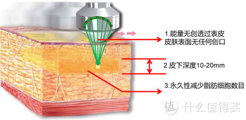 如何瘦小腿？把小腿变细的秘笈在这里