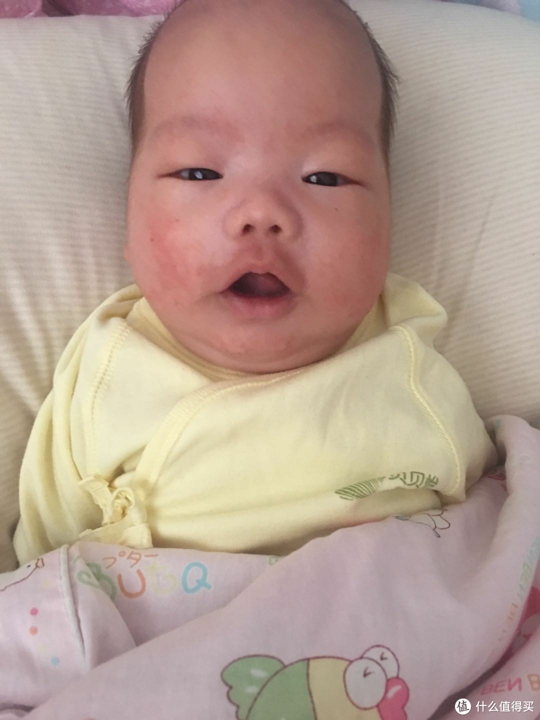 初夏来袭，二孩奶爸告诉你怎么对付婴幼儿湿疹