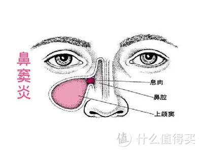 鼻窦结构