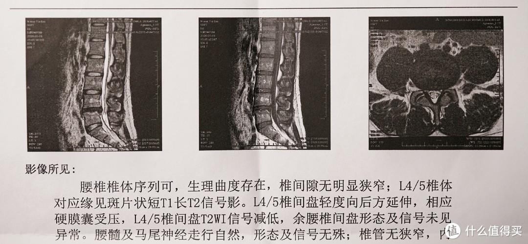 核磁扫描图