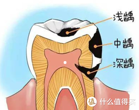 ​牙黄怎么办？看完你就懂了！