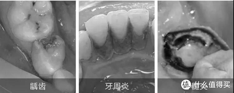 喝口冷水都酸牙？院线同款牙膏，一分钟告别牙齿敏感