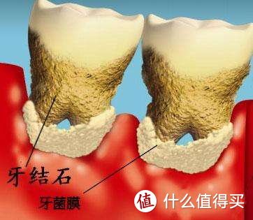 爱死这个萌翻老母亲的儿童电动牙刷——菲莱斯儿童牙刷