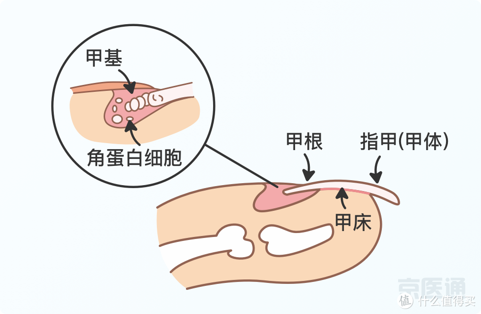 指甲上没月牙、有横线、长倒刺，是身体出问题了吗？