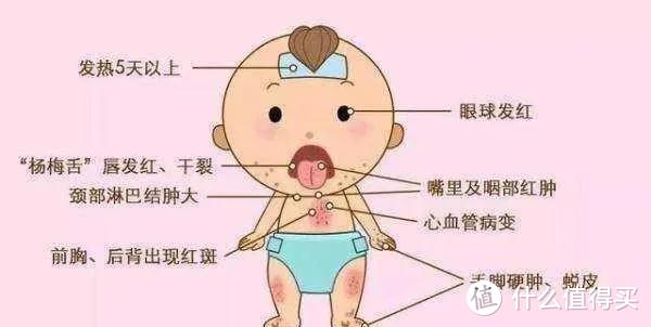 孩子得了川崎病，哪里是简单的感冒啊