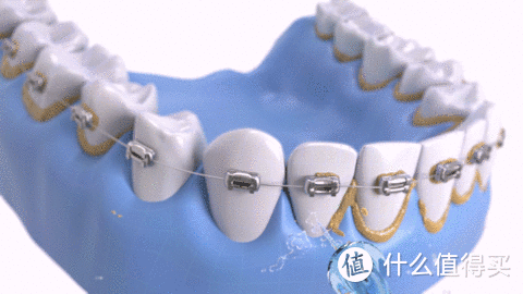 小米爆品颠覆牙医诊所！喷水三米远的冲牙器，在家就能洗牙