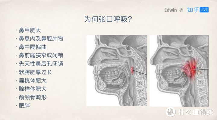 值无不言268期：儿童牙齿问题最强解读，从涂氟、窝沟封闭、矫正到日常维护