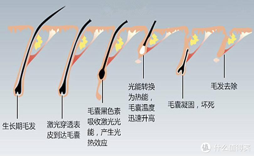 9种脱毛方式大PK！关于脱毛，你想知道的都在这儿了（建议收藏）