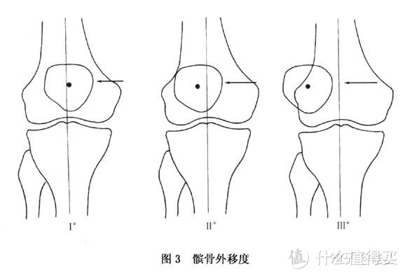 深蹲的好处是什么呢？如何正确的做深蹲？