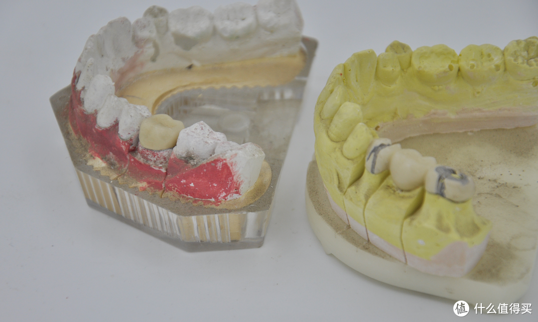 我经历过的牙科治疗：龋齿、拔牙、立事牙、根管治疗、烤瓷牙、儿童牙齿损伤