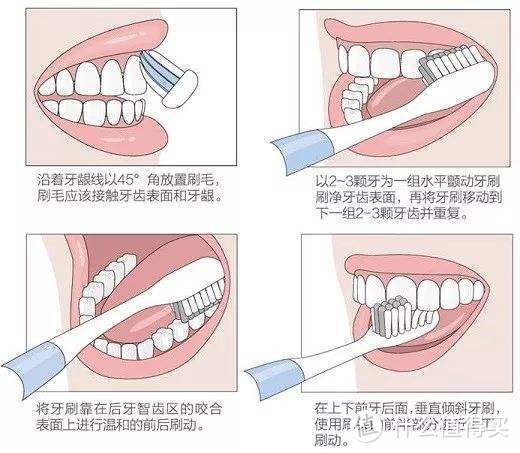 好惨一口牙：补牙、根管、修复、拔牙、洗牙，聊聊我的牙科经历