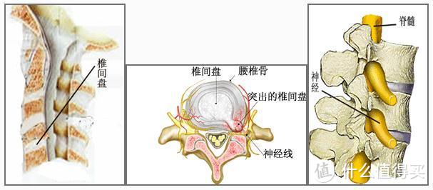 @上班族丨你，坐「错」了吗！（内附多视频）