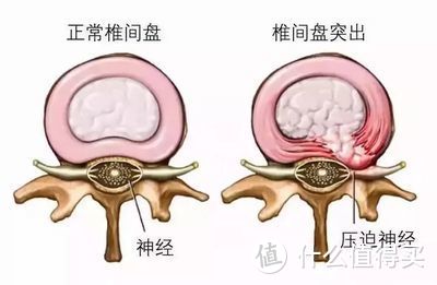 @上班族丨你，坐「错」了吗！（内附多视频）