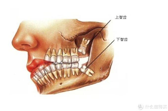 比金子都贵!确实,你的牙比金子都贵!