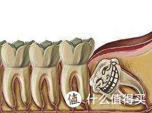 邪恶的智齿