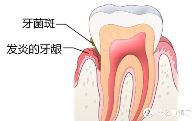2020年电动牙刷选购指南丨高性价比推荐