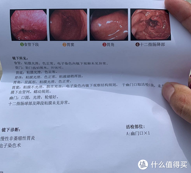 普通胃镜真的很普通 只要你敢做 结局绝对可以接受 健康服务 什么值得买