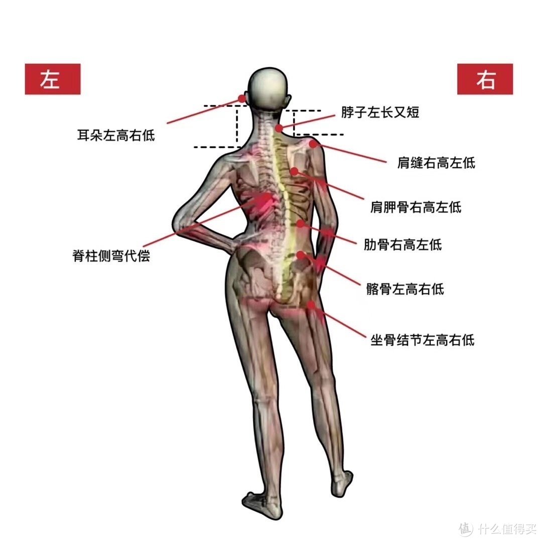 腰疼背疼，是肌肉拉伤还是坐骨神经痛？带你找到根源，六个动作去缓解