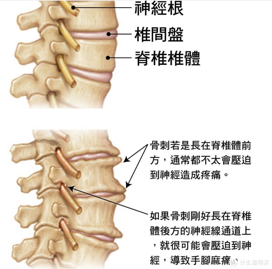 腰疼背疼，是肌肉拉伤还是坐骨神经痛？带你找到根源，六个动作去缓解