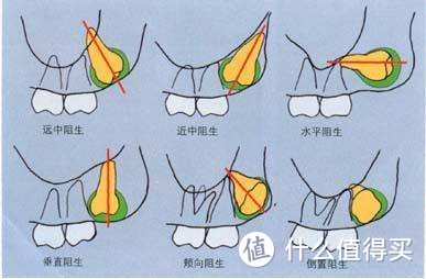 来自网络