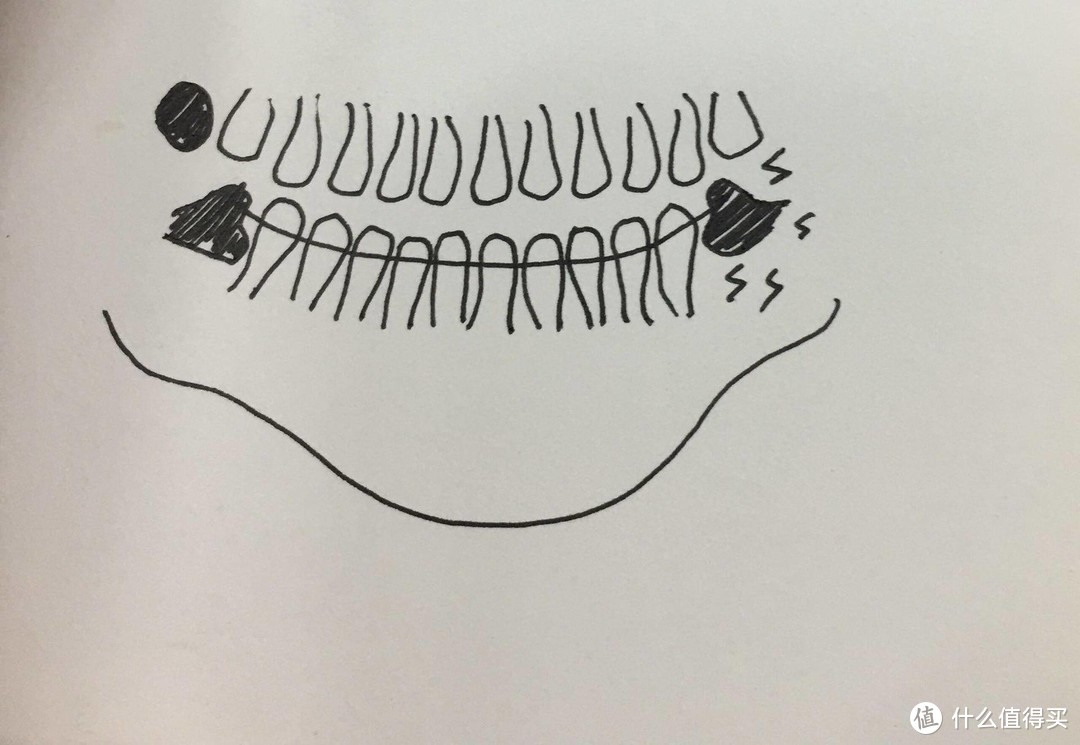 智齿该不该拔？记录超级怕疼星人鼓足勇气和智齿战斗的那些事