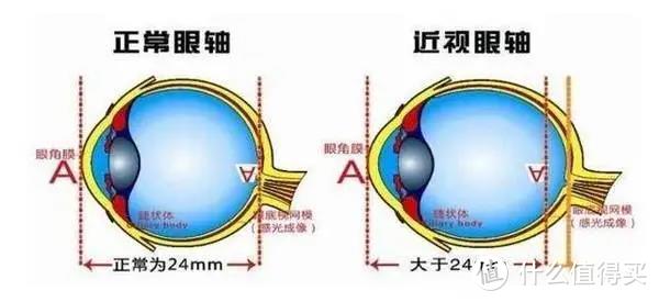 杨迪患眼疾上热搜：小小近视，差点让我被拒保！