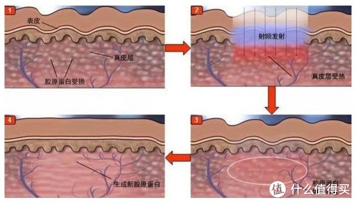 ​你还不知道这款成本小护肤效果显著的家用射频美颜仪吗？