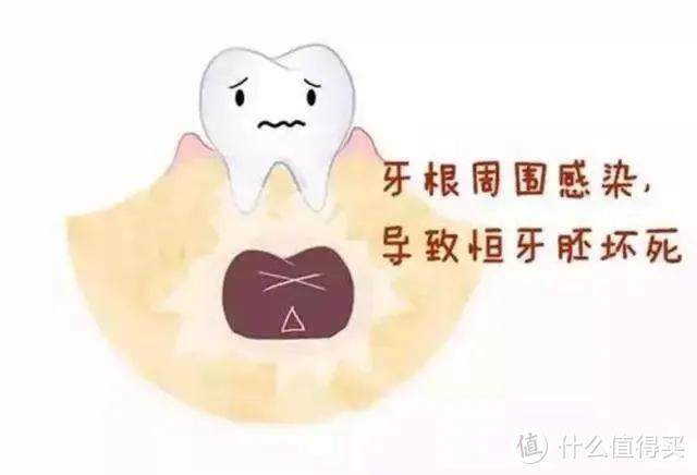 干货：儿童牙齿那点事儿 