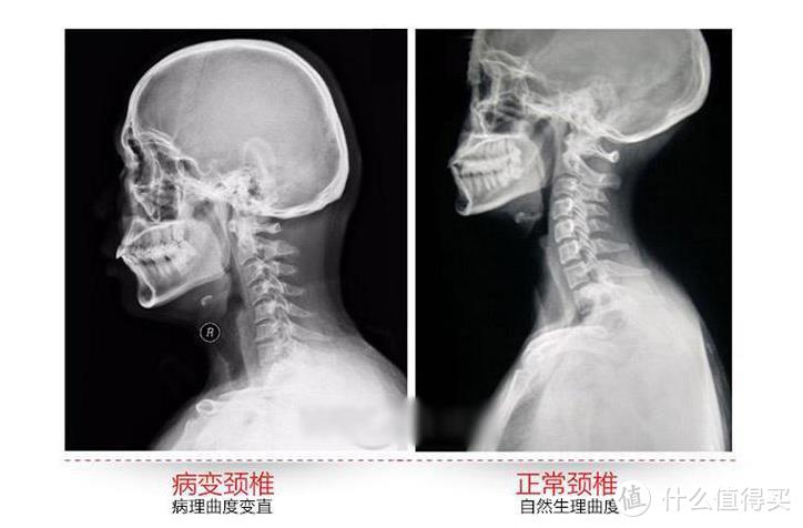 睡着觉就把颈椎给矫正了，这个枕头我替你们躺了一下