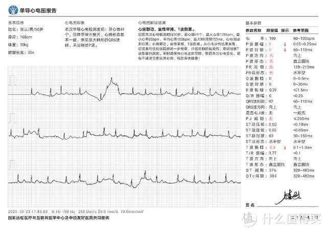 全面丰富的运动和健康监测 华为Watch GT2 Pro评测