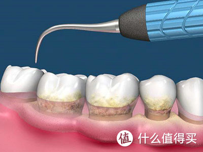 “曼妙小身材，惊人大能量！” 博皓冲牙器5025评测：它是您生活中不可多得的牙齿健康小帮手！