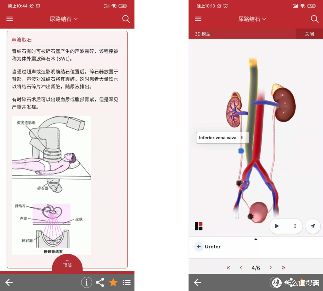 左图：手术图例；右图：泌尿系统的可交互3D模型
