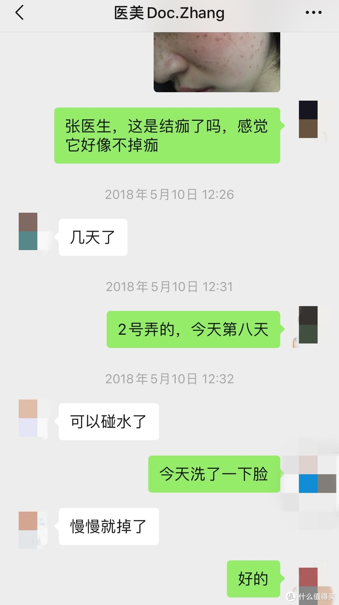 为了成为素颜女神，我去做了激光祛斑