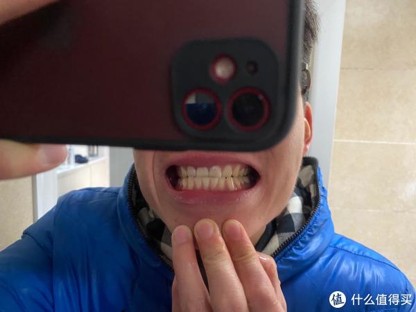 健康无小事 篇一:牙齿护理之我的第一次洗牙体验分享
