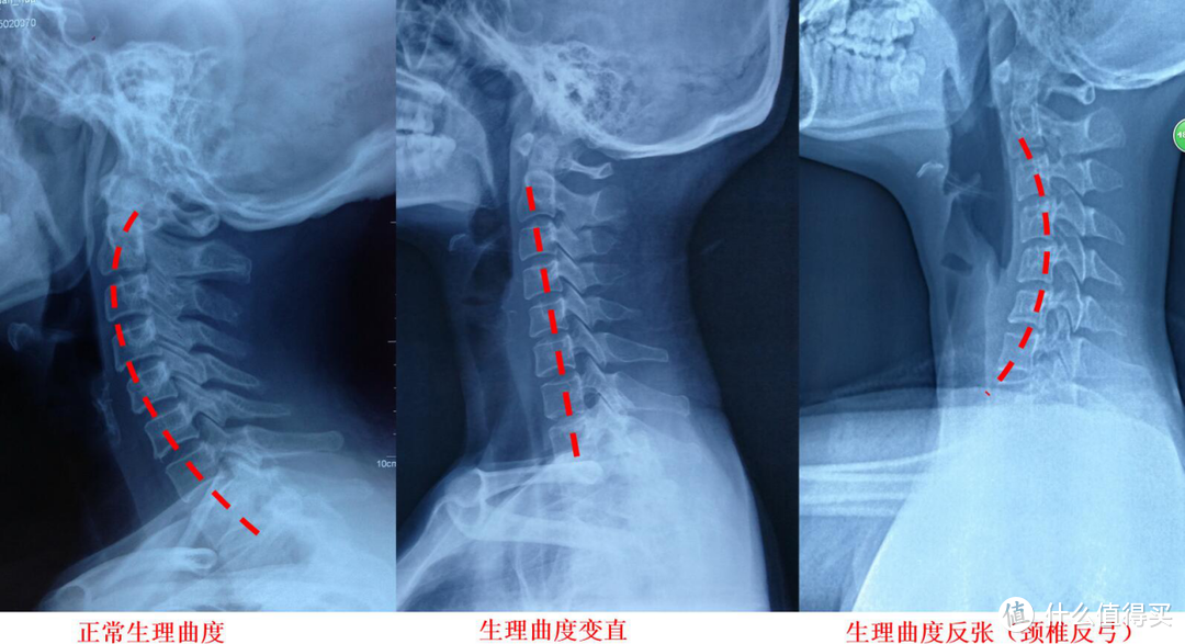 每日好物：长期低头的打工人适合什么枕头，资深颈椎病编辑良心推荐