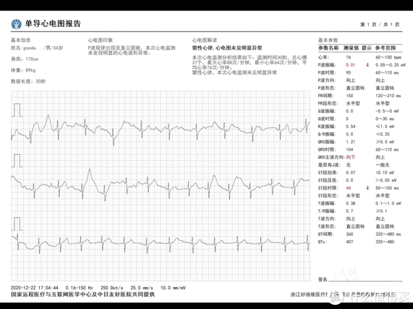 ecg报告