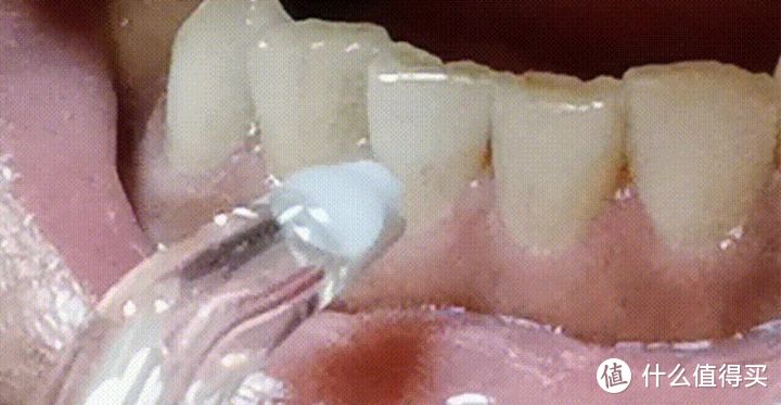 欧可林W1空气动力冲牙器：护龈洁齿、有氧冲牙
