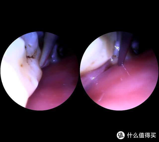 新一代口腔清洁神器 素诺智能可视超声波洁牙仪T11Pro评测