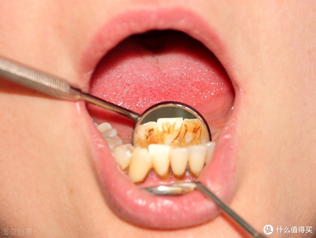 90后口腔护理爱用物清单深扒水牙线到底是不是鸡肋？