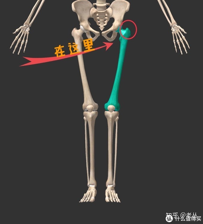 假胯宽其实就是大腿过于内旋和内收,股骨的骨性突起
