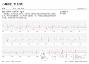 心电图分析