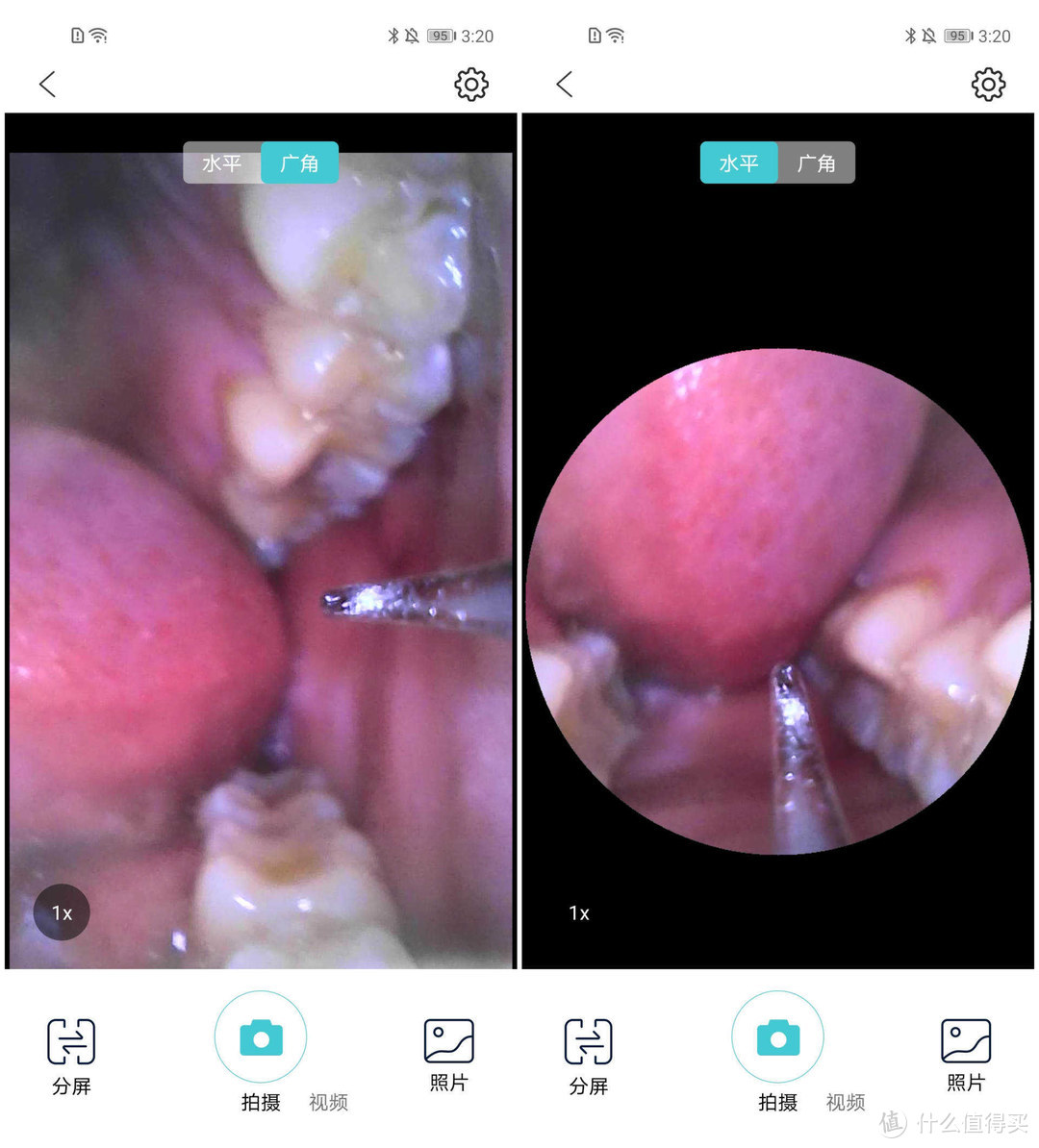 素诺T11Pro超声波可视洁牙仪，轻松清洁牙垢牙结石