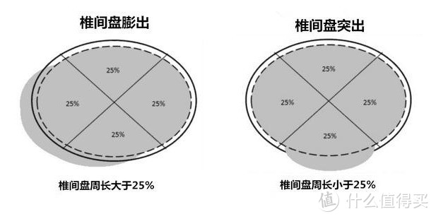 有了腰椎间盘突出，还能做硬拉吗？掌握科学的方法，视情况而定