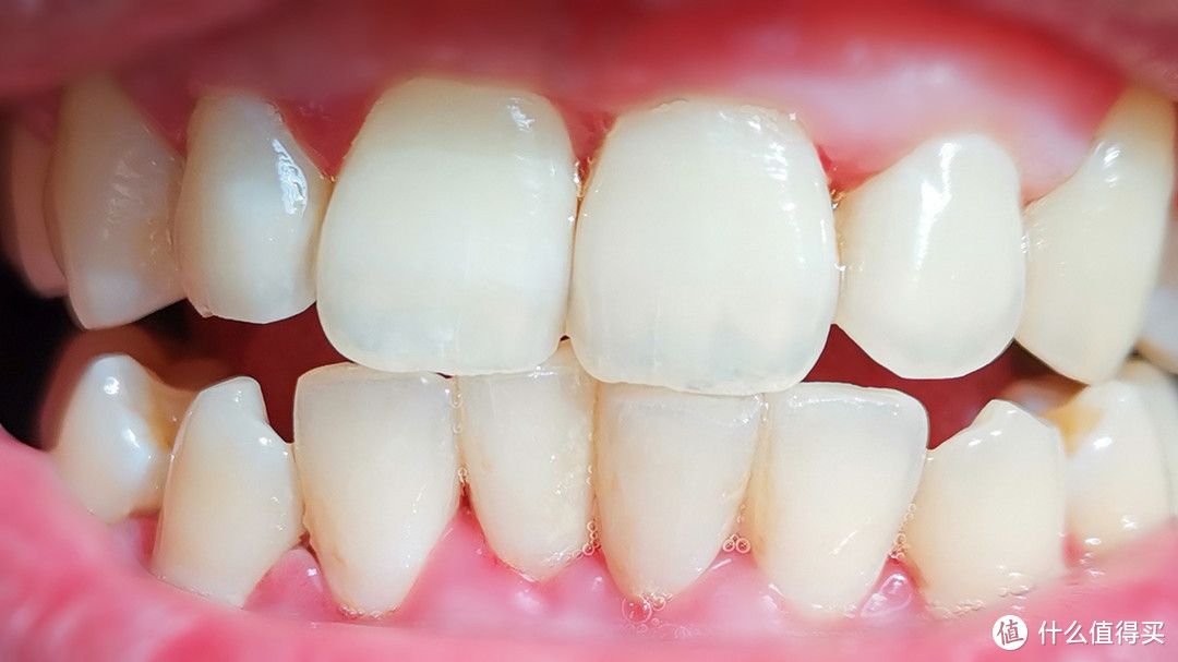 比电动牙刷更值得种草，实测牙结石全碎掉：素诺可视洁牙器T11Pro体验