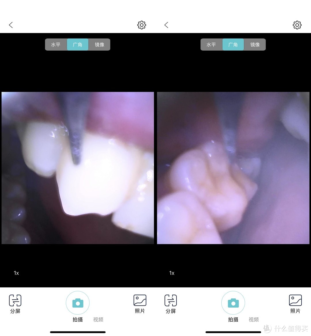 除了电动牙刷还用什么护齿？素诺可视超声波洁牙仪体验