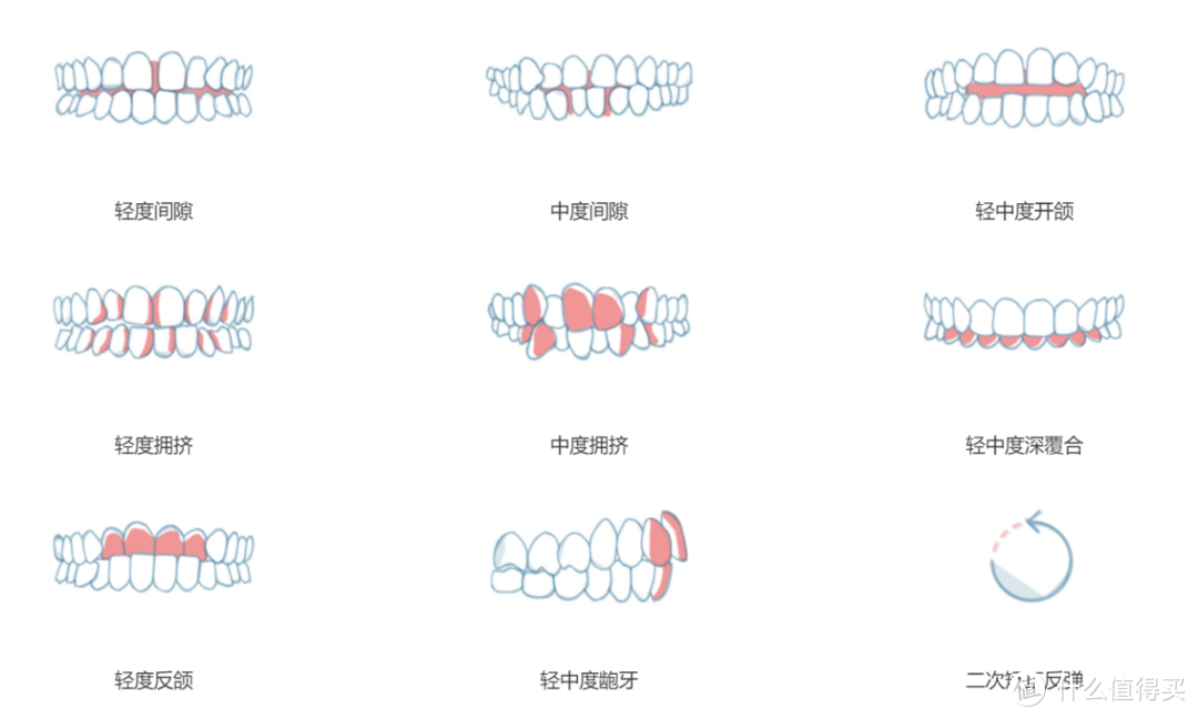 笑研所科普：牙齿隐形矫正前，你了解你的牙齿吗？