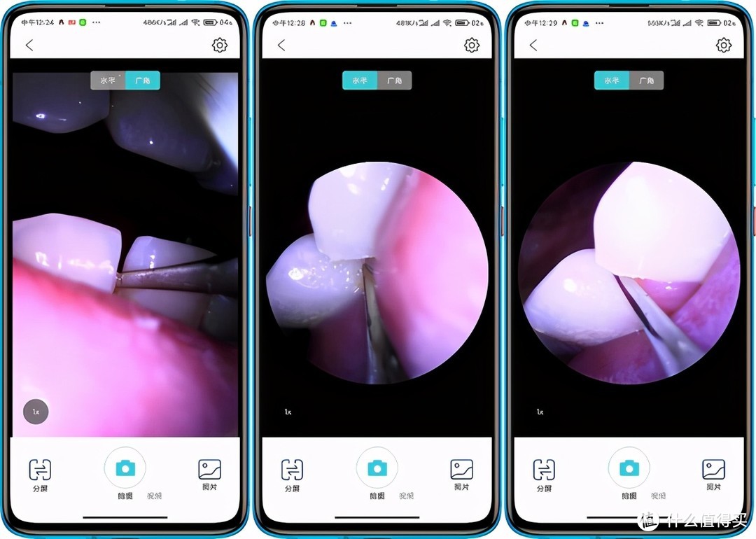 牙齿护理小助手——素诺智能可视超声波洁牙仪T11Pro全体验